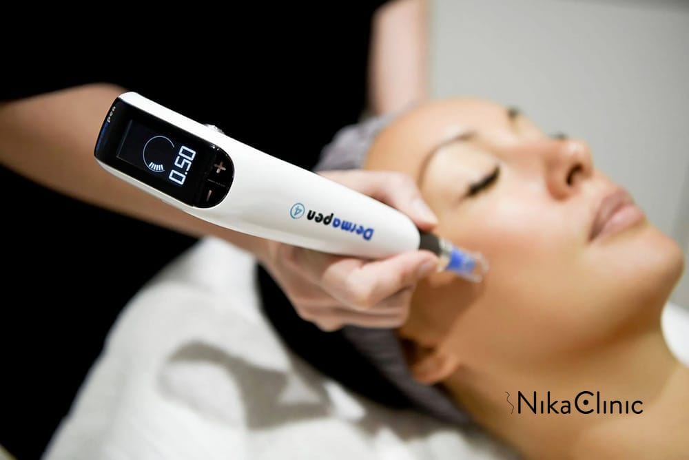 Dermapen a Milano presso Nika Clinic.