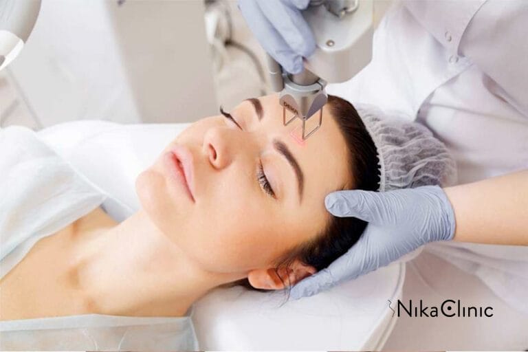 Trattamento laser CO2 alla Nika Clinic a Milano.