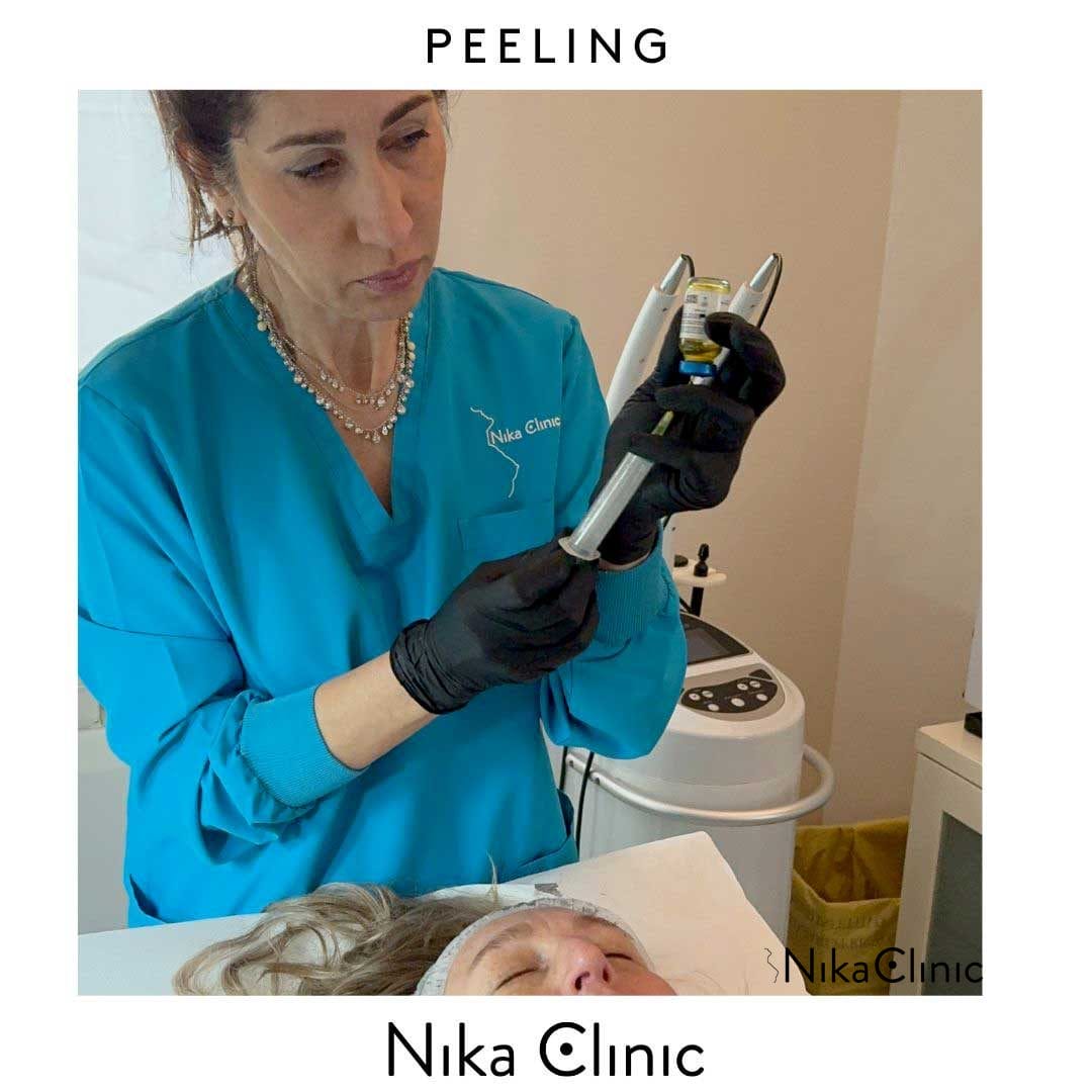 Una persona in uniforme blu e guanti neri aziona un dispositivo su un paziente sdraiato per un trattamento Peeling Viso. Il testo recita "PEELING" in alto e "Nika Clinic" in basso, evidenziando la loro competenza nella cura pelle.